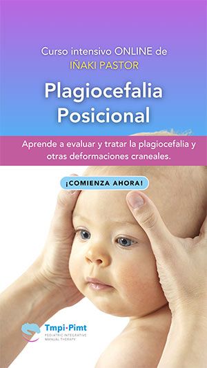 Plagiocefalia STKZ