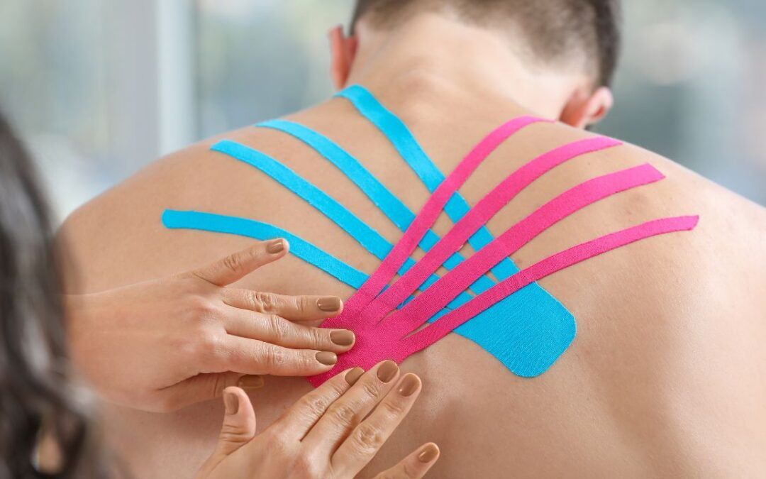 Vendajes Neuromusculares – Kinesiotaping