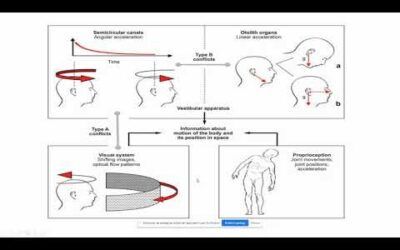 Cinetosis o mal de los transportes: seis conflictos sensoriales y un tratamiento